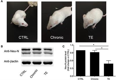 The Neurotropic Parasite Toxoplasma gondii Induces Astrocyte Polarization Through NFκB Pathway